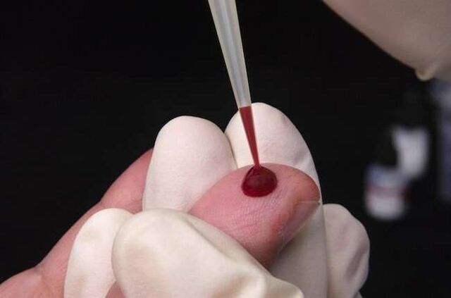 взяття крові для аналізу на паразитів