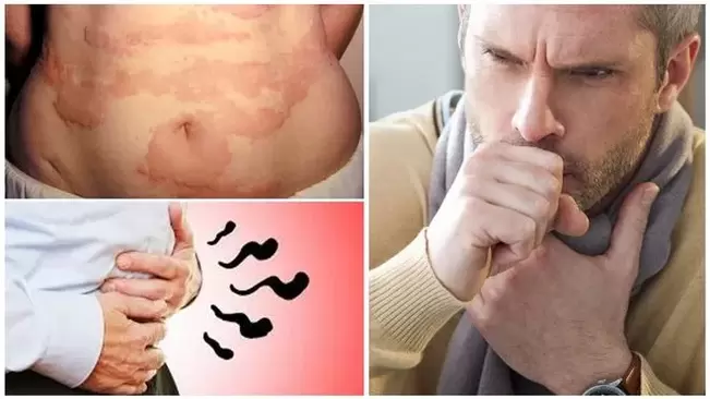 Алергія, кашель та здуття – ознаки ураження організму глистами